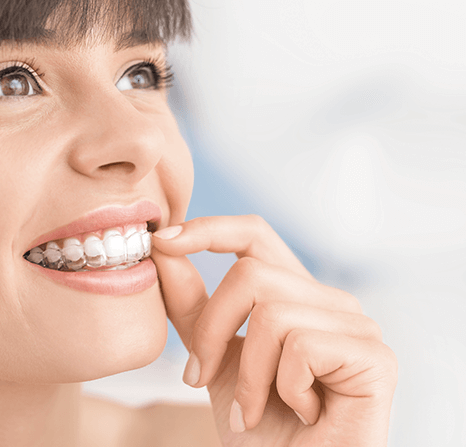Female student taking off her invisalign