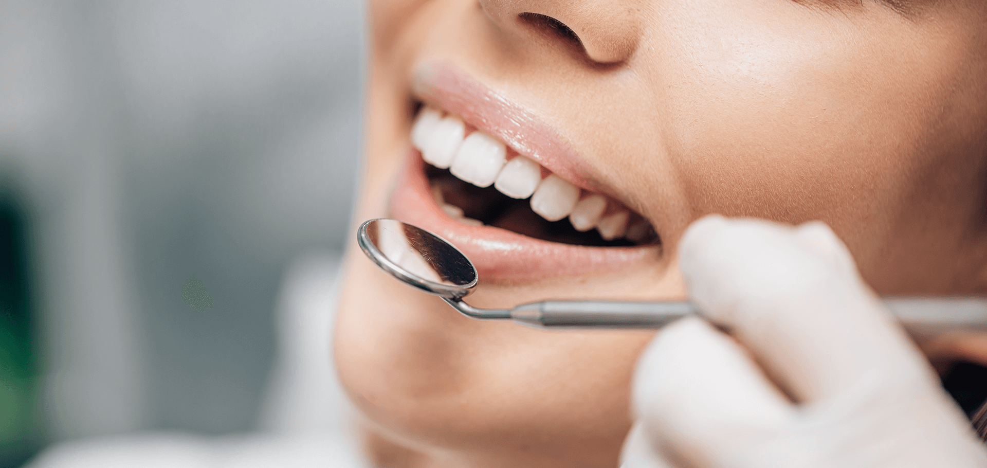 A patient with beautiful set of teeth
